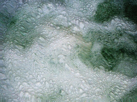 A white and green organic texture with humps.