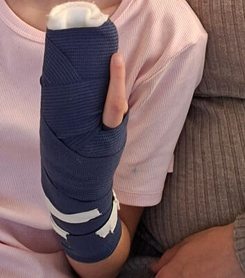 Ausschnitt aus einem Foto der zehnjährigen Aurora mit Mutter: Das Foto zeigt die Gipsschiene, die das Kind hochhält. Sie ist blau mit weißen Klebestreifen. Sie trägt ein rosa T-Shirt. Die Mutter sitzt daneben im beigen Pulii und legtden Arm um die Tochter