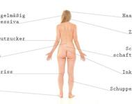 Eine weibliche gelesene nackte Person von hinten. daneben Anmerkungen: nimmt regelmäßig Antidepressiva, Haarausfall, hoher Blutzucker, Schwangerschaftsabbruch, Zahnfäule, Inkontinenz, Meniskusriss, Fußpilz, Schuppenflechte
